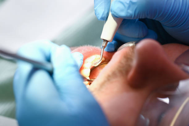 Best Emergency Treatment for Oral Infections in Davis, OK