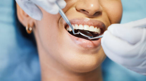 Best Emergency Wisdom Tooth Extraction in Davis, OK