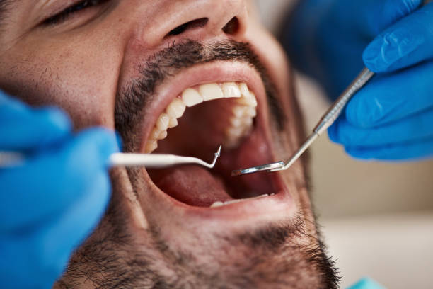 Best Urgent Dental Care for Toothaches in Davis, OK